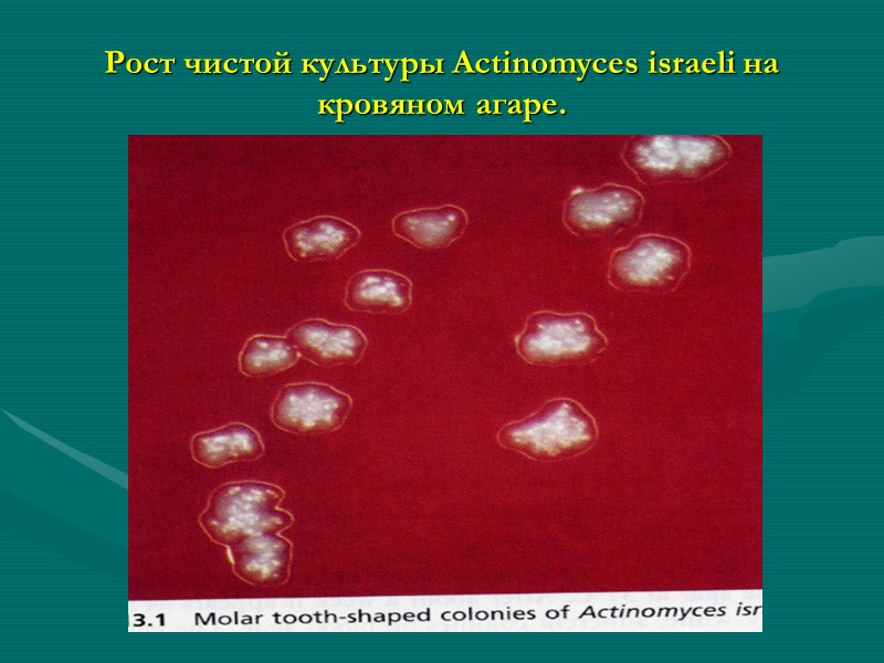 Рост чистой культуры Actinomyces israeli на кровяном агаре.